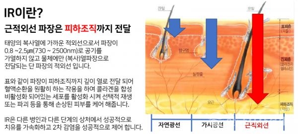 IR이란?